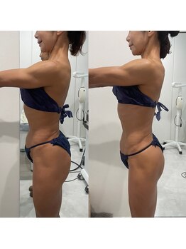 ベリッセ(Belisse)/下っ腹をなんとか！？痩身エステ