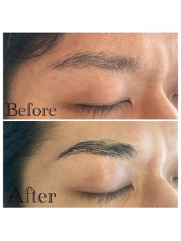 マンケイブ(MAN CAVE)/施術事例