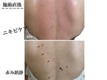 ドゥクス 難波店(Dux)/背中ケア◎ブライダル◎