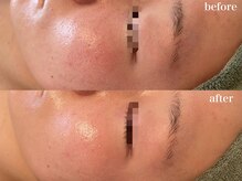 リボーン 浜松(reborn)/