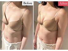 ラビス(RAVIS)/産後のバストも復活！！