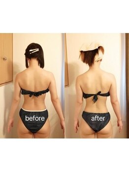 アンジュ/【背中二の腕はみ肉撃退】コース