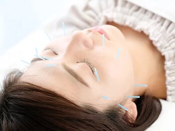 高麗鍼灸院の写真/【千駄ヶ谷で本場韓国の施術を！】お肌のハリやツヤが気になるあなたに、韓国式美容鍼をおすすめします♪