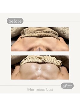 フルアナ(Hu ruana)/バストアップ/バストケア
