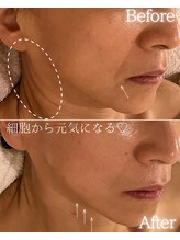 ココロ(COCORO)/お肌とカラダを整えるセルラム