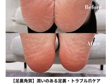 アナンダサロン(ananda salon)の雰囲気（フットバスやフットシャンプーから始まる角質や爪周りのケア）