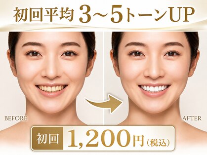 ココホワイトニング 天王寺店の写真