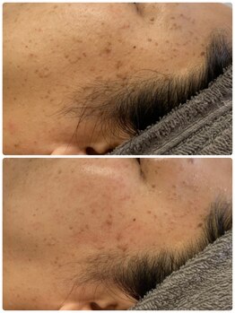 サロンドール(SalonDoll)/陶肌トリートメント