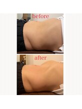 ウナ デ リンゴル 恵比寿店(UNA de Ringol)/脱ぽっこりお腹！男性にも人気♪