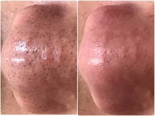 鎌倉美肌シェービングルーム あじさい/