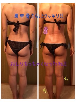 リーズサロン(REs.salon)/【20代】1回でこの変化！