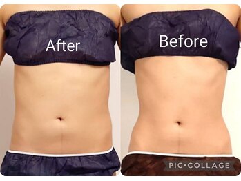 オアシス(OASIS)/結果重視ボディメイクならOASIS