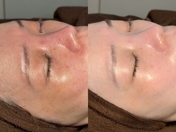 ルーナジェーナ(Luna llena)/池袋　エステ　ルーナジェーナ