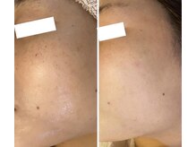 ルコア ドゥ(rucor doux)/肌悩みもお任せ♪