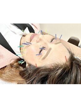 鍼灸施術を受けたい