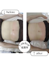 ユニクリア(Uni clear)/痩身エステ★脂肪燃焼剤