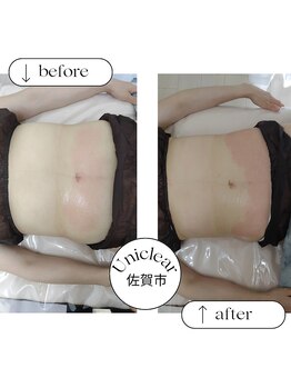 ユニクリア(Uni clear)/痩身エステ★脂肪燃焼剤