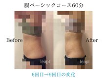 リープル(Leapl)/【腸もみ】腸もみ後の変化写真