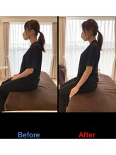 リ エスペランサ(Re.Esperanza)/整体/東十条駅/赤羽駅/鍼灸/腰痛