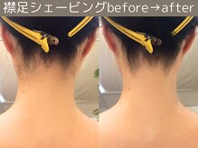 ももとゆでたまご/襟足シェービングbefore→after