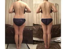 ソウイボディ 武蔵小杉店(Sou-i body)/お客様before→ after