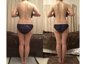 ソウイボディ 武蔵小杉店(Sou-i body)/お客様before→ after