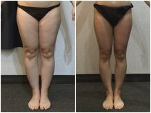 美容整体 ウェリナ 蟹江院/小顔矯正/骨盤矯正/痩身整体