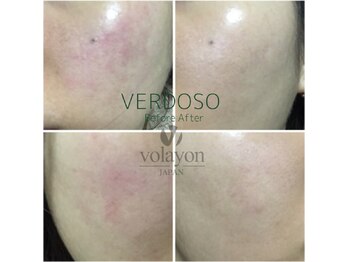 ベルーナビューティ 西新宿(Beluna beauty)/ベルドソ管理 ビフォーアフター