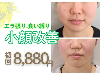 ララエピの写真