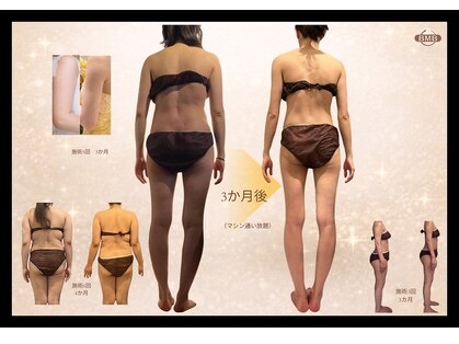 ビーエムビー(BMB)の写真