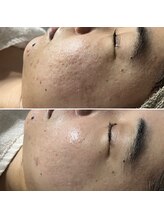 レアリゼ(Realiser)/大阪クリスティーナ