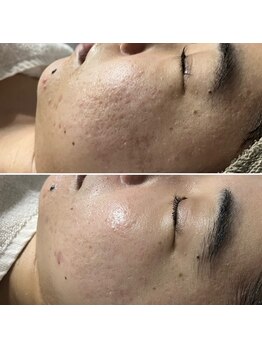 レアリゼ(Realiser)/大阪クリスティーナ