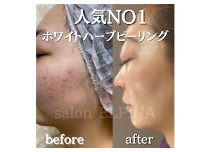 サロン エルピナ(salon ELPINA)の写真