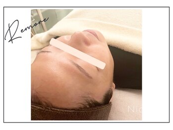 リモア(REMORE)/《お客様》エンビロン肌質改善