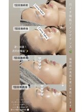 クレヴィー(Creviy)/月イチハーブメンテで美肌を更新