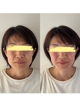 美健家/before⇒after