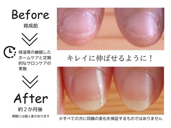 セル(Cell)/自爪育成のお問い合わせは・・・