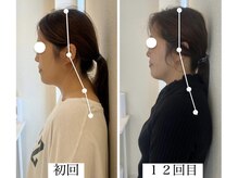 ラボーテヴェリテ(La Beaute Verite)/【お客様施術例】