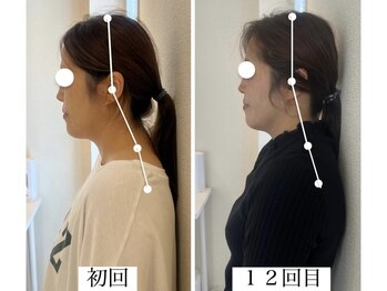 ラボーテヴェリテ(La Beaute Verite)/【お客様施術例】