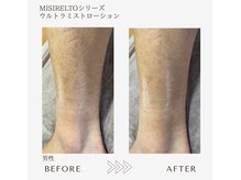 サロンエイトミー 西船橋店(salon 83)/before→after