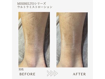 サロンエイトミー 西船橋店(salon 83)/before→after