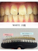 ホワイト 川越店(WHITE)/平均のトーン