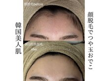サロンドジェシカ(salon de Jessica)の雰囲気（顔脱毛☆産毛レスつるんと肌に♪今だけお試し2回¥6,900）