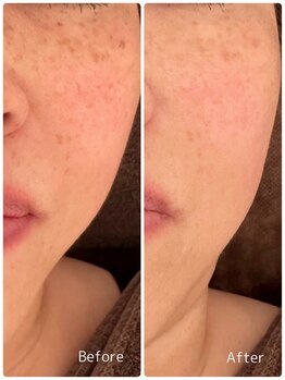 ククル(KUKULU)/ハーブ11回目♪(40代女性)