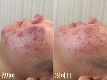 プライベートサロン ラウレア(Laule'a)/