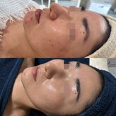 リボーン(be reborn)