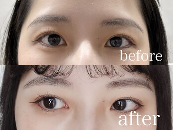 シエナ アイ(CIENA eye)/