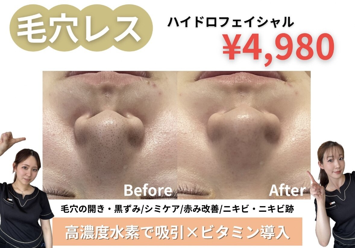 エクラ(ECLAT)｜ホットペッパービューティー