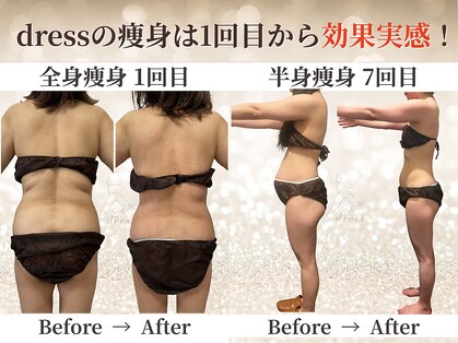 ドレス(dress)の写真
