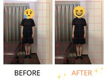 ベル/50代の方の姿勢Before After